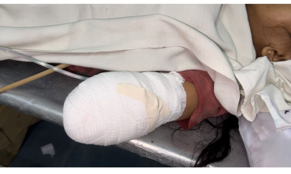 The surgical team of Kegalle General Hospital successfully reattaches a severed arm!