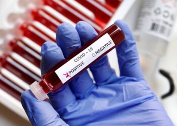 Fake blood is seen in test tubes labelled with the coronavirus (COVID-19) in this illustration taken March 17, 2020. REUTERS/Dado Ruvic/Illustration