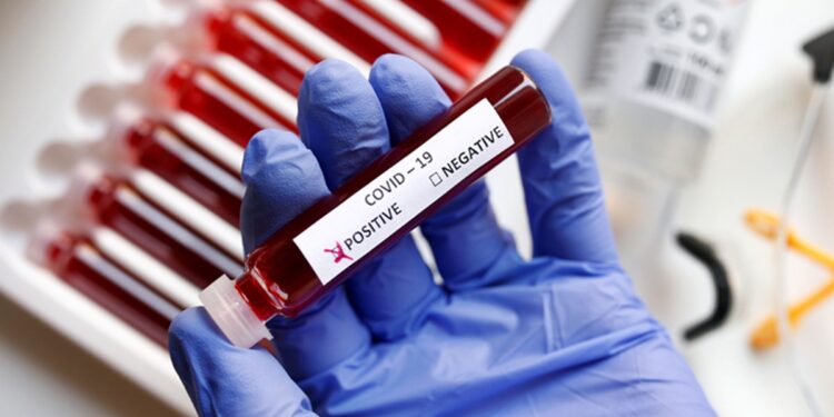 Fake blood is seen in test tubes labelled with the coronavirus (COVID-19) in this illustration taken March 17, 2020. REUTERS/Dado Ruvic/Illustration