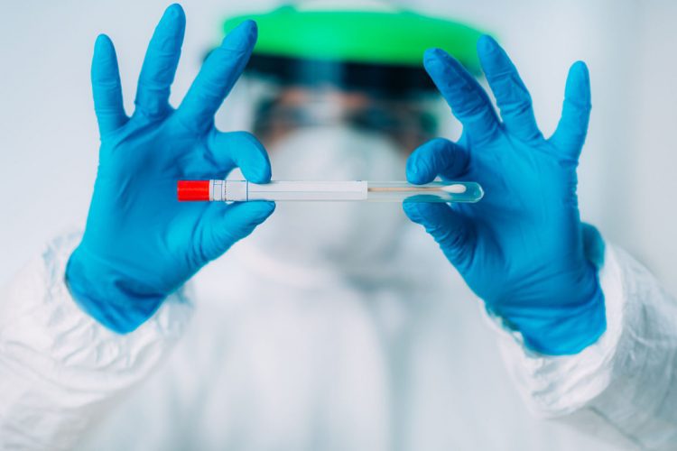 Corona virus test kit - Swab sample for PCR DNA testing
