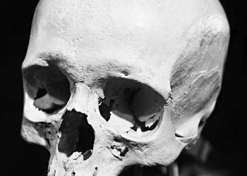skull