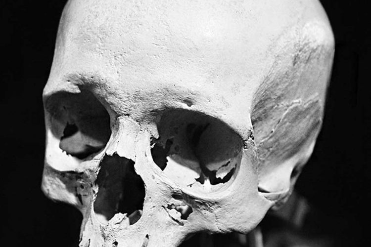 skull