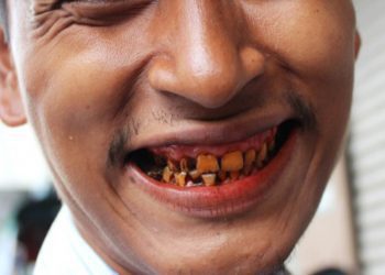 betel-nut-