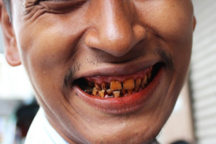 betel-nut-