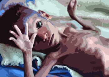 malnutrition