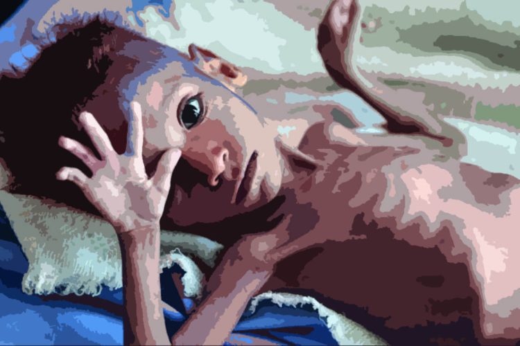 malnutrition