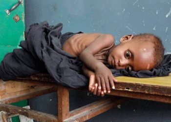 malnutrition