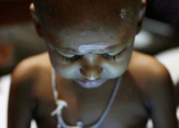 S. Saksan, 5, who has been diagnosed with leukaemia, rests at a cancer care transit home near Apeksha Hospital, Colombo, Sri Lanka, August 16, 2022. "Due to the current crisis in Sri Lanka, we are facing severe problems in transport and food," said his mother Sathiyaraj Silaksana, "I have no option but to pay for my son's needs. My husband, is a construction worker. In order to pay for all these expenses we pawned our jewellery." REUTERS/Kim Kyung-Hoon    SEARCH "SRI LANKA CANCER" FOR THIS STORY. SEARCH "WIDER IMAGE" FOR ALL STORIES.