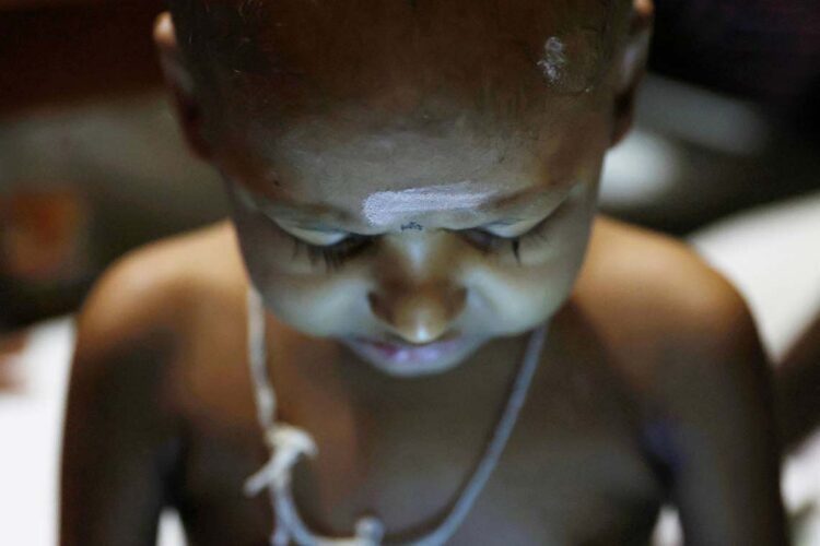 ලියුකේමියා රෝගයෙන් පෙළෙන 5 හැවිරිදි නොදරුවෙක් - රොයිටර්
