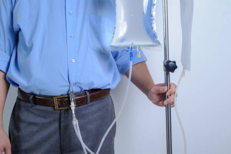 Peritoneal Dialysis user with catheter and saline bag