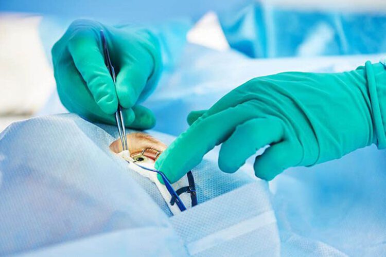 eye-surgery