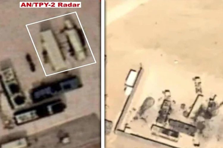 THAAD-Radar